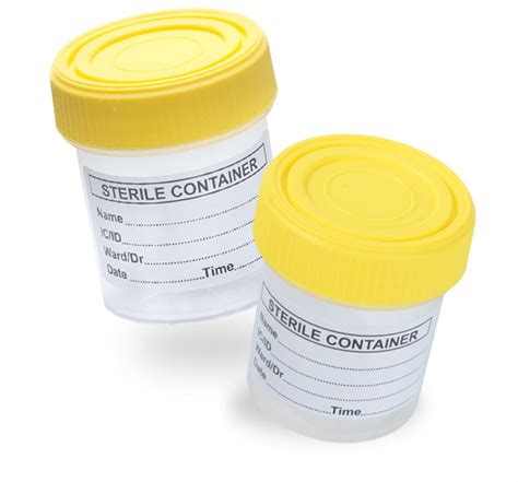 Urine Container