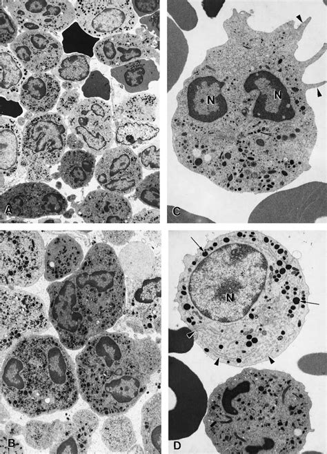 Electron Micrographs Of Bone Marrow Cells From A Myelokathexis Patient