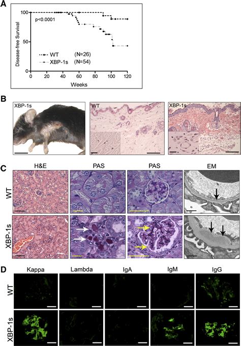 The Differentiation And Stress Response Factor XBP 1 Drives Multiple