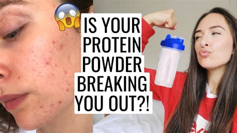 Protein Powder Causing More Acne Youtube