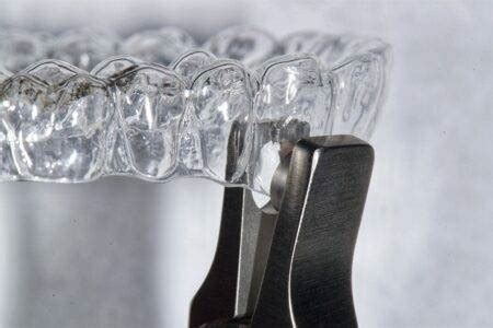 Enhancing Clear Aligner Treatment with Attachments and Auxiliary ...