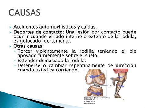 Ligamentos Cruzados Fernando Z Iga Ppt