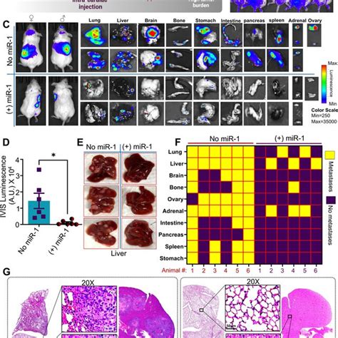 Ectopic Overexpression Of Mir 1 Decreases Tumor Growth And Metastasis