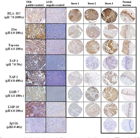 Figure 3 From Down Regulation Of Human Leukocyte Antigen Class I Heavy