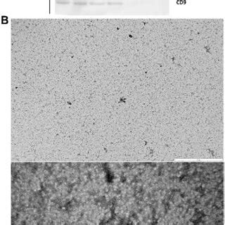 Plasma Ev Characterisation Using The Following Methods A Western