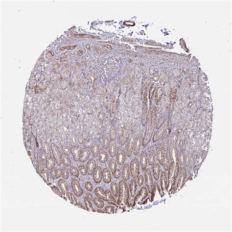 Tissue Expression Of Fap Staining In Stomach The Human Protein Atlas