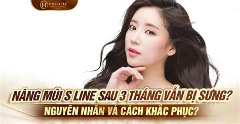 Nâng Mũi Sau 3 Tháng Vẫn Bị Sưng Nguyên Nhân Và Cách Khắc Phục