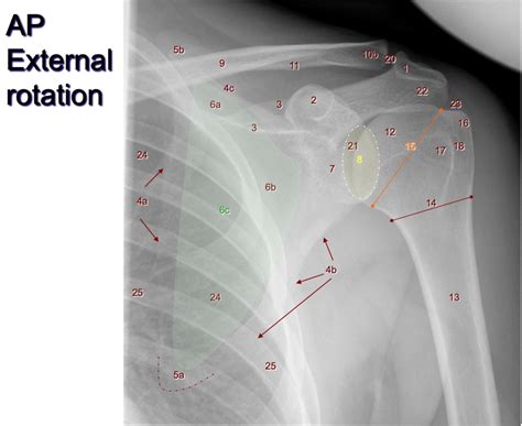 Diagram Of AP Shoulder External Rotation Quizlet