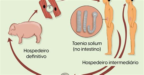 Cisticercose Disseminada O Que é BRAINCP