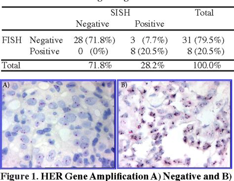 Figure 1 from Determination of HER2 gene amplification in breast cancer ...