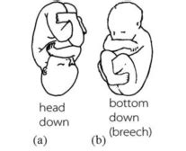 Fetus Definition And Examples Biology Online Dictionary