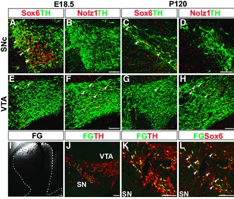 Sox6 And Nolz1 Are Selectively Expressed In SNc And VTA Dopamine