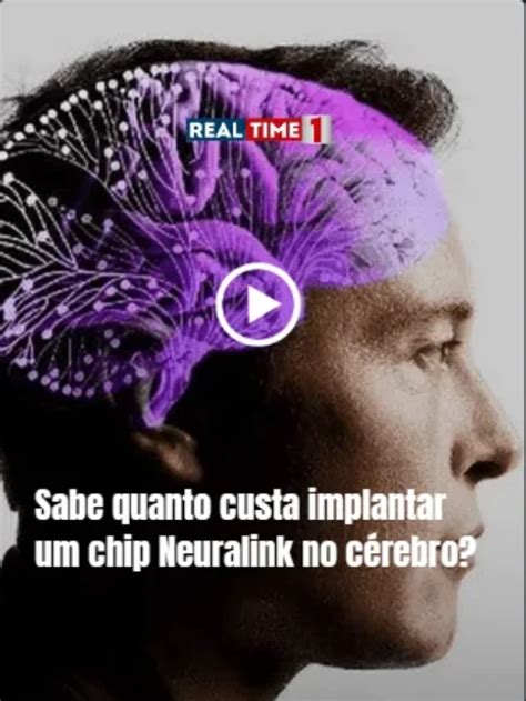 Sabe quanto custa implantar um chip Neuralink no cérebro RealTime1