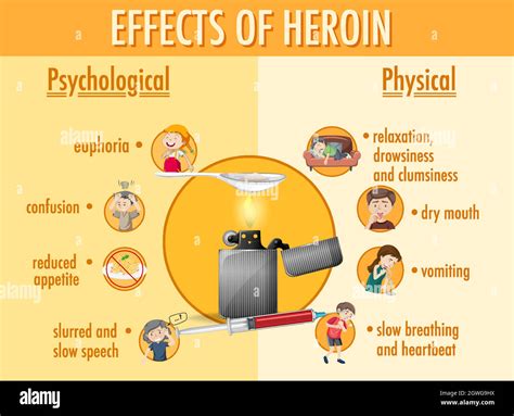 Efectos De La Infograf A Informativa Sobre La Hero Na Imagen Vector De