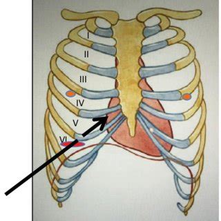 Intercostal Space Diagram