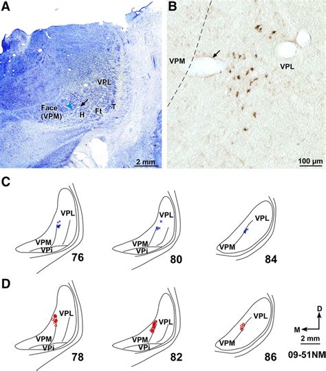 A Photomicrograph Of A Nissl Stained Coronal Section Of The Thalamus