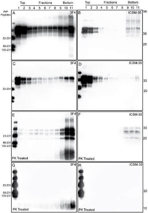 Fractionation Of Mutant And Wild Type PrP Sc Aggregates In GSS P102L