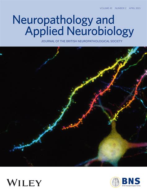 Tdp Pathology And Functional Deficits In Wildtype And Als Ftd