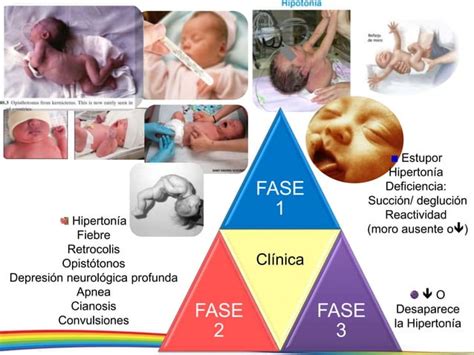 Ictericia En El Reci N Nacido Ppt