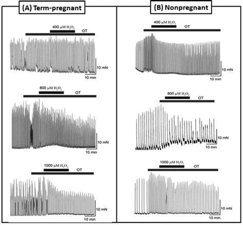 Original Recordings Showing The Contractile Responses Of Uterine Strips