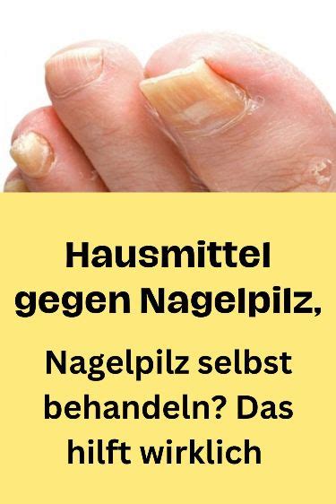 Hausmittel Gegen Nagelpilz Nagelpilz Selbst Behandeln Das Hilft