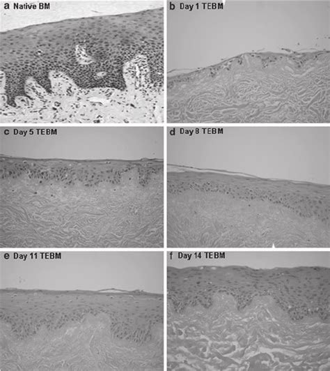 Tissue Engineered Oral Mucosa At Different Time Points Post Ali Hande