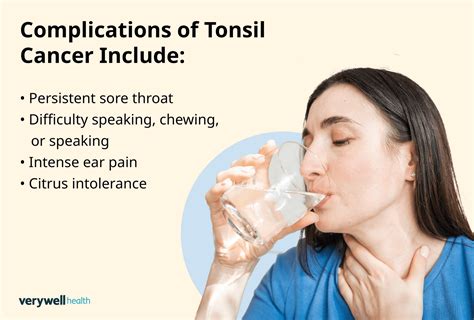 Tonsil Cancer Symptoms: Pain, Lymph Nodes, Swallowing