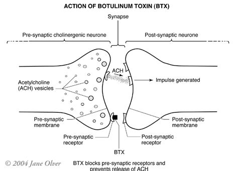 Botulinum Toxin The Whiteson Lab Uci