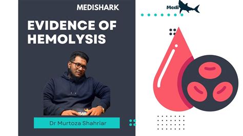 Evidence Of Intravascular Haemolysis Dr Murtoza Shahriar YouTube