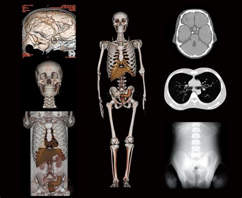 Ct Whole Body Phantom Pbu Radiology Medical Imaging Orion