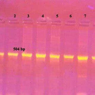 Ethidium Bromide Stained Agarose Gel Of Pcr Amplified Products From