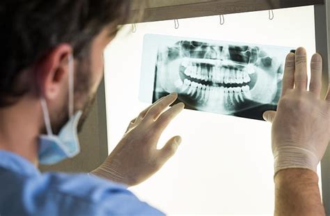 Radiation On Dental X-Rays - Rockefeller Cosmetic Dentistry