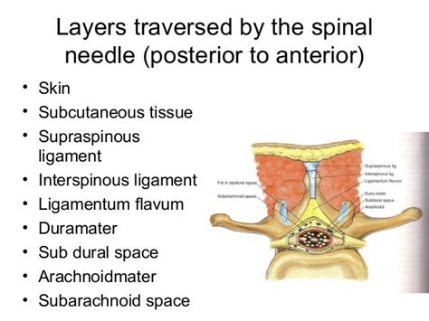 Spinal Anaesthesia