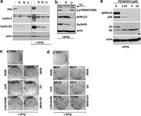 Effect Of Mek Inhibitors On Senescence Associated Cyclin D1 And Rp A