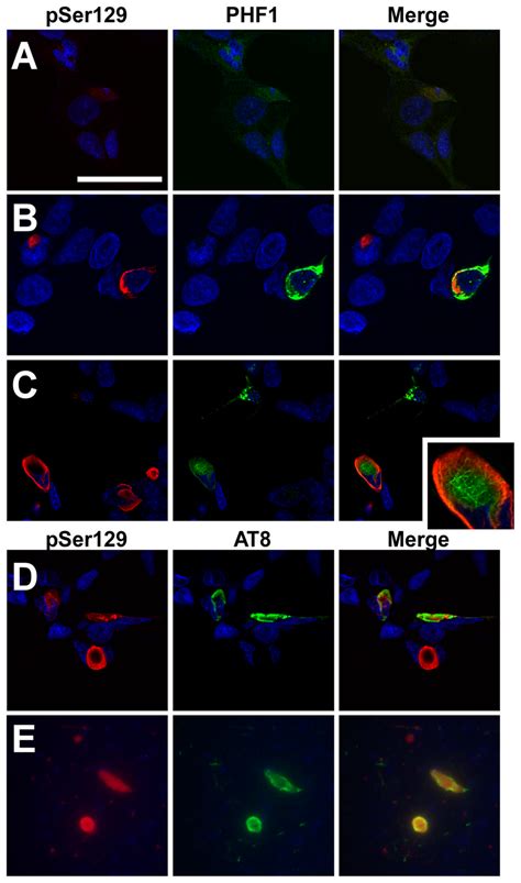 Representative Confocal Microscopy Of Double Immunofluorescence With