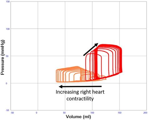 Left Ventricular Pressure Volume Pv Loops Illustrating Severe