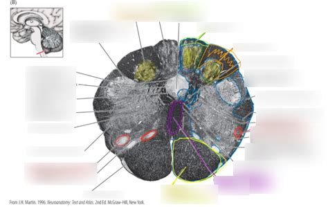 Caudal Medulla Diagram Quizlet