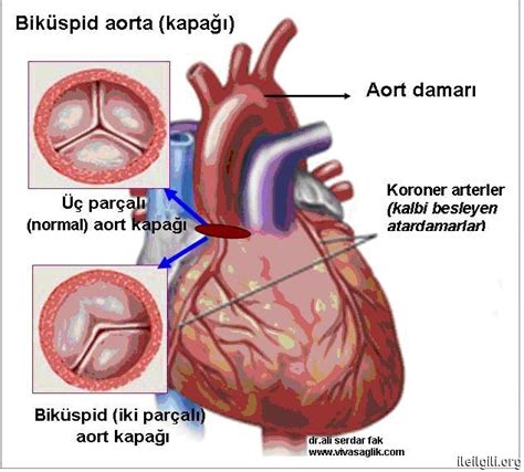 ihlal etmek reddetmek vererek mitral kapak anatomisi Menşei merkez