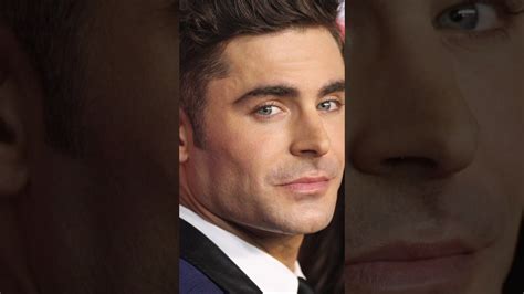 El Accidente Que Cambio El Rostro De Zac Efron🥺 Zacefron Sabiasque