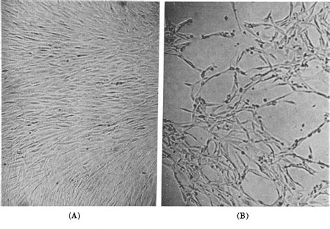 Figure From Interallelic Complementation In Hybrid Cells Derived From