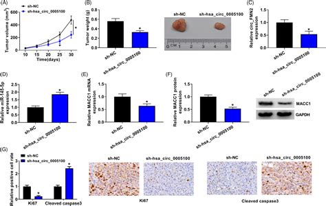 Hsa Circ 0005100 Regulates Tumorigenicity Of Colorectal Carcinoma Via