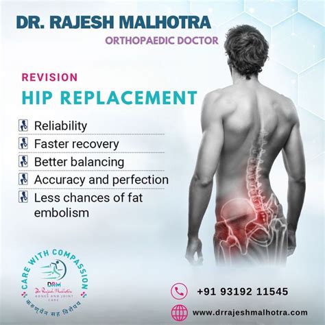 Dr Rajesh Malhotra Orthopaedic Doctor