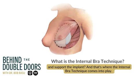 What Is The Internal Bra Technique Youtube