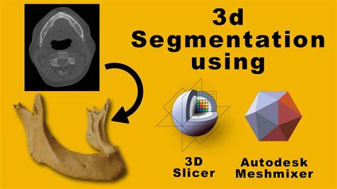 3d Segmentation Workshop Dicom To Stl Model Using 3d Slicer Youtube