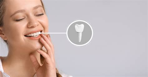 Complete Guide To Dental Implant Procedure