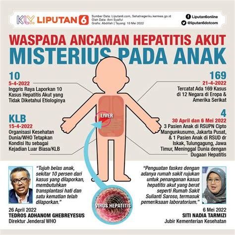 Infografis Waspada Ancaman Hepatitis Akut Misterius Pada Anak