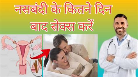 नसबद क कतन दन बद सकस करन nasbandi ke kitne din bad sex