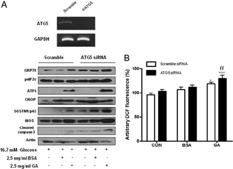 The Autophagy Inhibition By Knockdown Of Atg5 Further Increased The