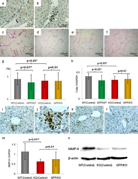 Comparison Of Liver Fibrosis Using Tnfr1 Ko Mice A B Anti Gfp