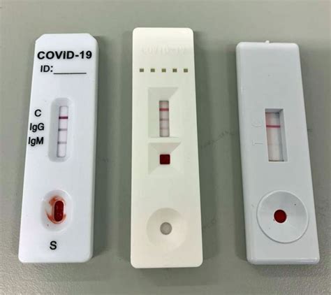 Fergus Walsh I Was Gobsmacked To Test Positive For Coronavirus